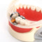 50 Stück/Box Dental Prime Teeth Interproximaler Kunststoffkeil mit Schutz