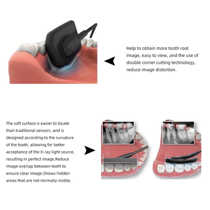 Sistema de imágenes de rayos X intraorales digitales Sensor de rayos X RVG dental y para mascotas USB