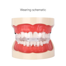 Orthodontische apparaatuitlijners voor zachte en harde tanden Trays Tandentang