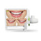 17 pulgadas 10 millones de píxeles WIFI Digital LCD AIO Monitor Dental cámara intraoral