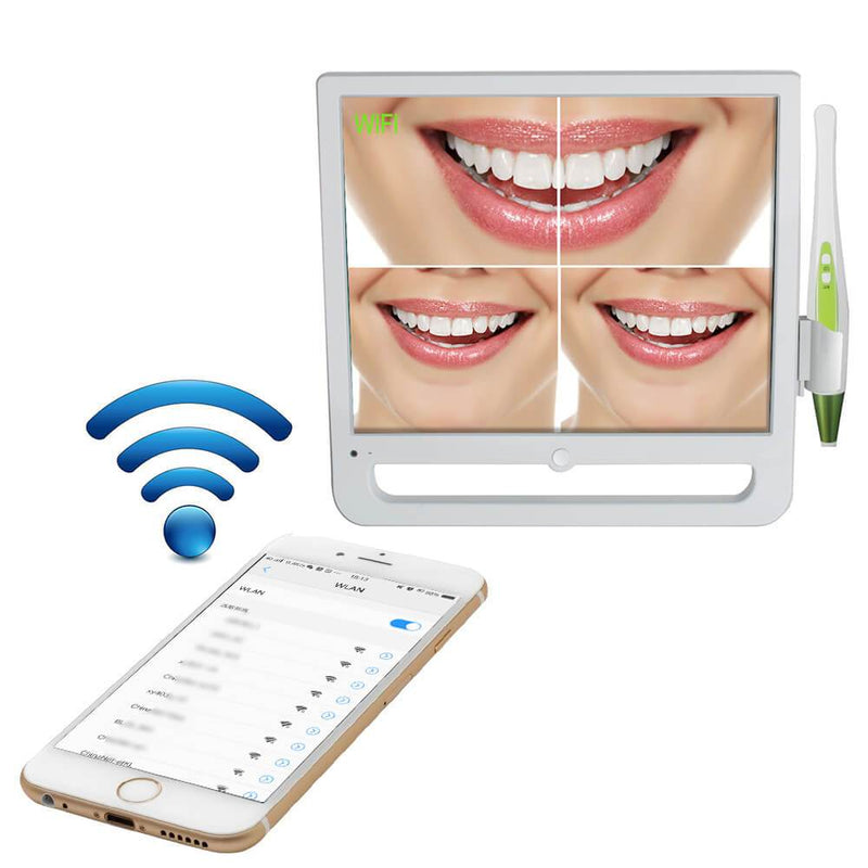 17 Inch 10 million pixels WIFI Digital LCD AIO Monitor Dental Intra oral Camera
