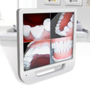 Moniteur AIO LCD numérique haute définition + caméra intra-orale dentaire