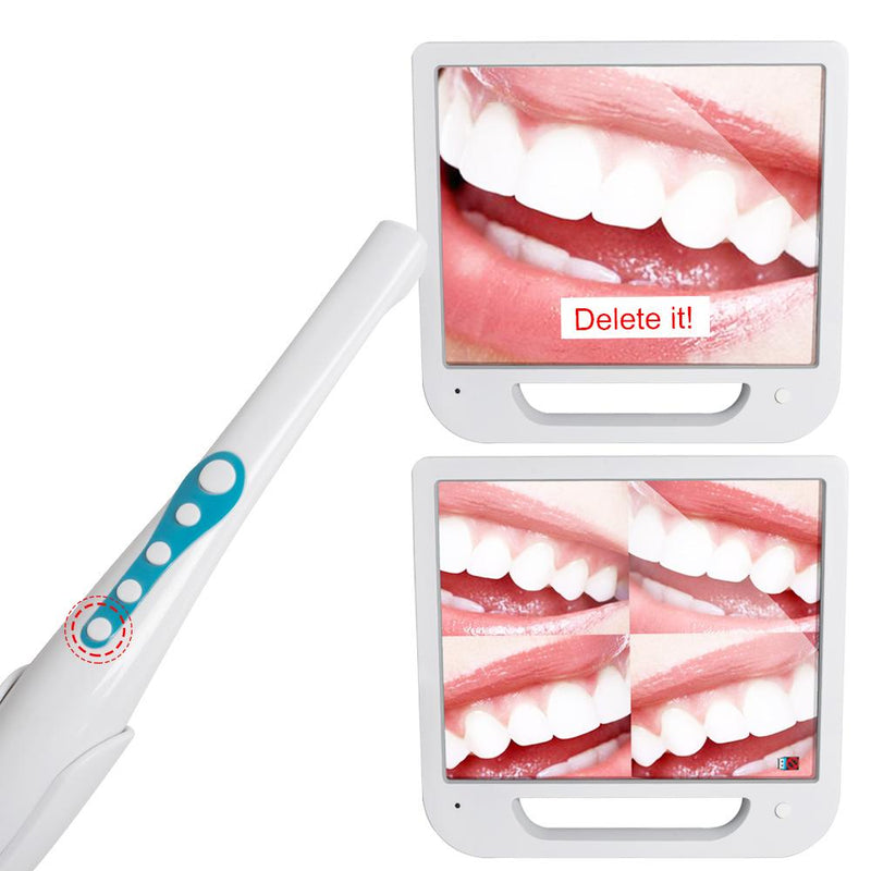 High-definition digitale LCD AIO-monitor + tandheelkundige intra-orale camera