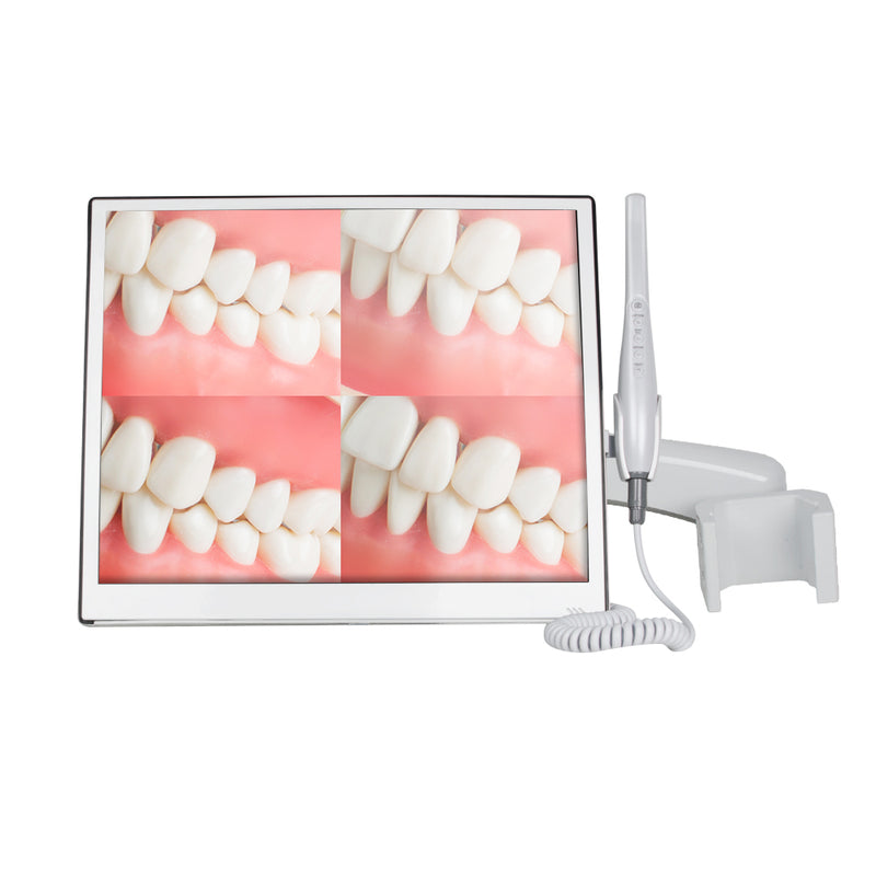Ultrasottile WIFI 8 Milioni di Pixel Ad Alta Definizione 17 '' Digital LCD AIO Monitor Dentale Intra Orale Camera 110 V/220 V