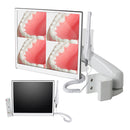 Ultrasottile WIFI 8 Milioni di Pixel Ad Alta Definizione 17 '' Digital LCD AIO Monitor Dentale Intra Orale Camera 110 V/220 V