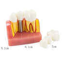Dimostrazione dentale Denti Modello Analisi dell'impianto Crown Bridge