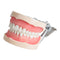 Model Tand Universele Plaat 200H Type Verwijderbare Tanden: