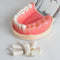 Model Tand Universele Plaat 200H Type Verwijderbare Tanden: