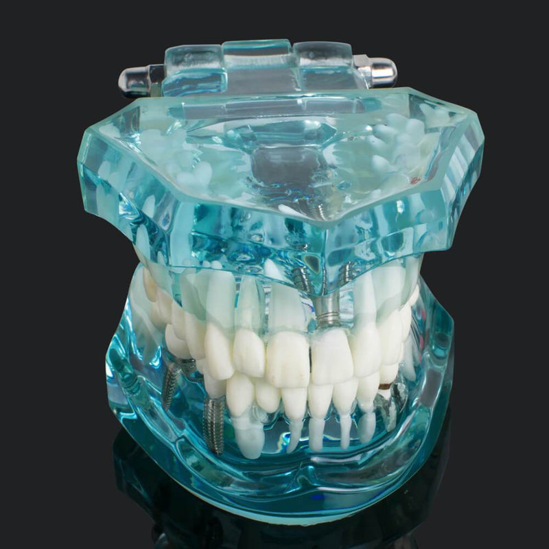 Modèle de dents pathologiques adultes transparentes de dent d'étude dentaire