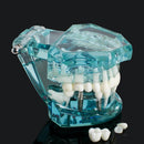 Tandheelkundige studietand transparant volwassen pathologisch tandenmodel