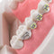 Dental Teach Study Adult Typodont Demonstration Teeth Model with Brackets