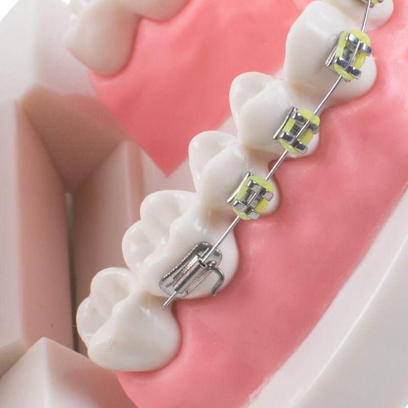 Dental Teach Study Volwassen Typodont Demonstratie Tanden Model met Beugels