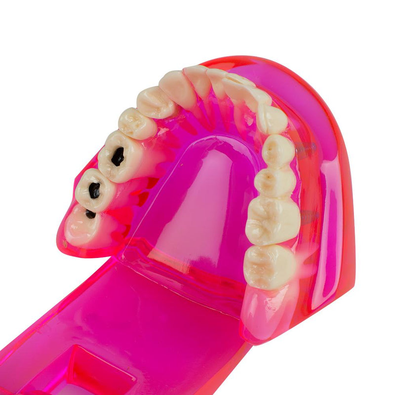 Modello di denti dentali Insegna allo studio Restauro e patologia dell'impianto orale
