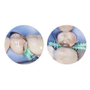 40 pz/scatola Dentale Adattivo Cunei Thorn Matrix 134 ℃ Fissaggio Elastico Cuneo Diastema