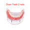 Restauration de modèle d'implant de dents de prothèse dentaire