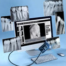 Digital Sensor X-ray Radiovisiograph High-Frequency Lenght 2.8m Dentistry Intraoral Digital System H D Image Tools