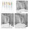Dental NiTi Super Root Canal File Rotary 31mm Tip Diverse Spiral Flute Angle