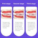 Kieferorthopädische Aligner für weiche und harte Zähne Zahnglätter