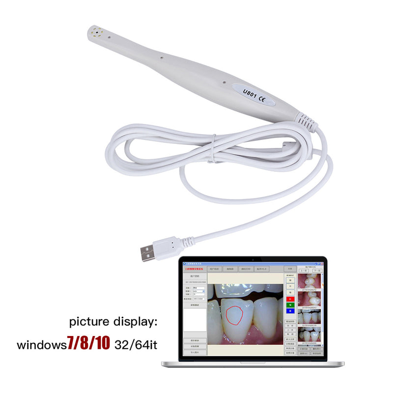 Caméra intra-orale d'endoscope oral numérique dentaire 6/8 blanc froid