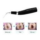 Opération ultrasonique sans fil dentaire Endo Activateur ultrasonique