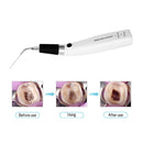 Dental Wireless Ultrasonic Operation Endo Ultrasonic Activator