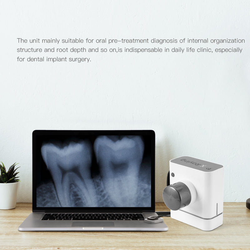 Tandheelkundige röntgeneenheid Hoge frequentie draagbare röntgenmachine